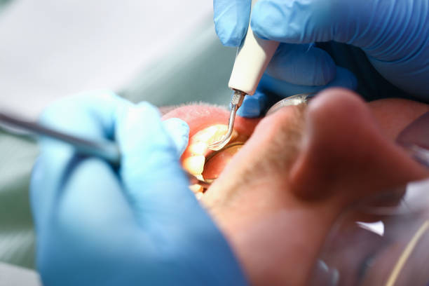 Best Walk-In Emergency Dental Services in Parsons, KS